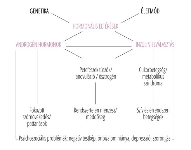 PCOS alap 1